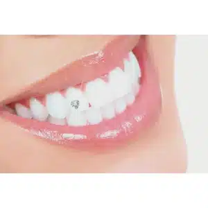 Formation en bijou dentaire